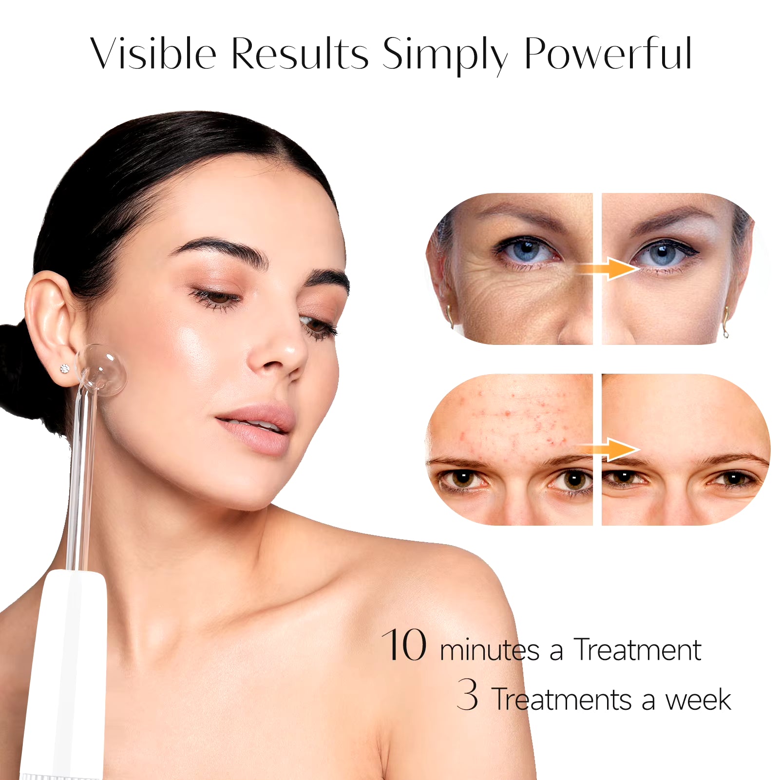 Blue 6-In-1High Frequency Facial Machine for Hair Face anti Aging Therapy Acne Tool Fusion Neon+Argon Wands Skin Care