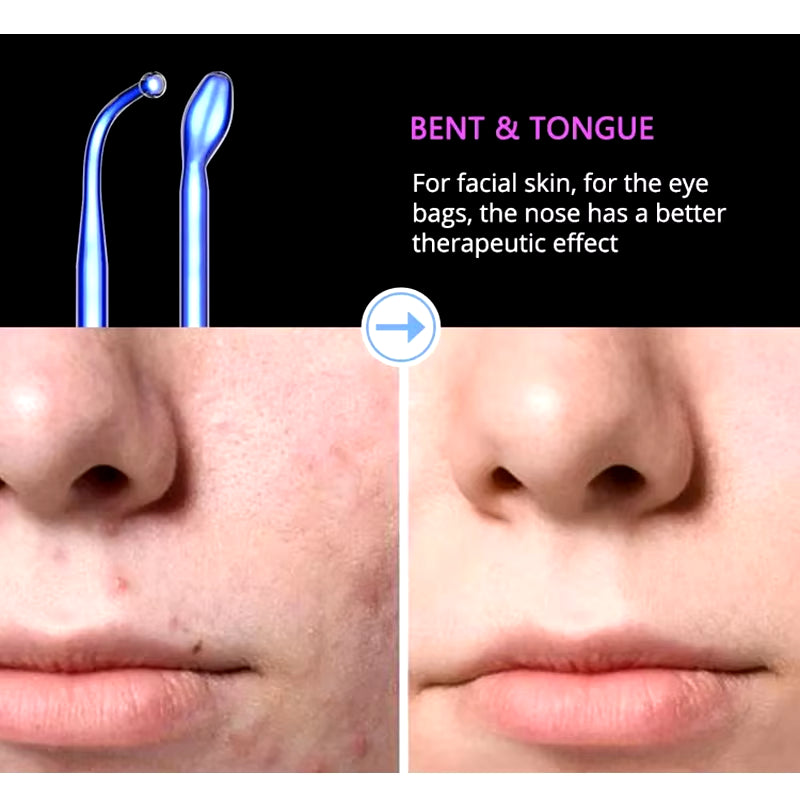 Blue 6-In-1High Frequency Facial Machine for Hair Face anti Aging Therapy Acne Tool Fusion Neon+Argon Wands Skin Care