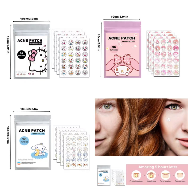 96/100/120Pcs Sanrio Cinnamoroll Repair Acne Patch Facial Skin Care Fade Blemishes Pimple Marks Closed Acne